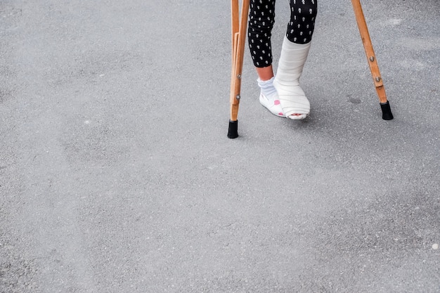 Criança usando muletas e pernas quebradas para caminhar. Perna quebrada, muletas de madeira, lesão no tornozelo.