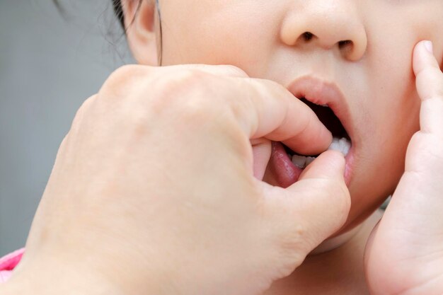 Crianças com dor de dente tratamento médico remova o dente e esmalte-o para primeiros socorros
