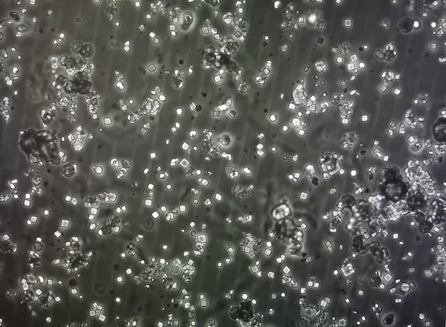Foto cristais de ácido úrico oxalato de cálcio di-hidratado em sedimento urinário