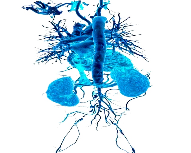 CT-Angiographie zur Diagnose von Traumata bei Gefäßerkrankungen. Angiogramm des ganzen Körpers. medizinisches Konzept.