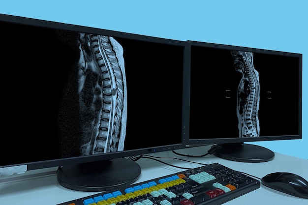 Foto ct médica ou mri ou pet thoracici espinha digitalizar filme em um monitor de computador consultório médico tecnologicamente avançado e funcional