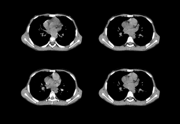 CT-Scan der Brust und kreative MRT-Bilder