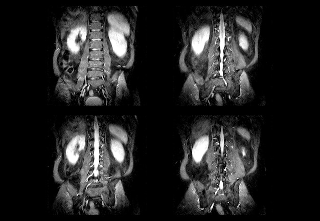 CT-Scan der unteren Wirbelsäule und professionelle MRT-Bilder