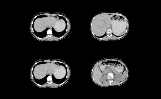 CT-Scan und MRT Abdomen professionelle Bilder