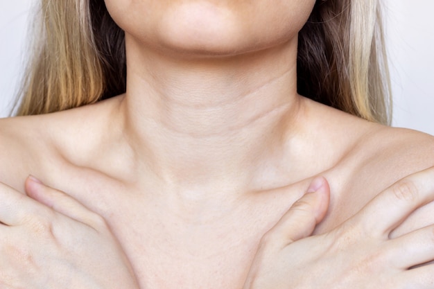 Cuello y pecho de una mujer joven Líneas en el cuello