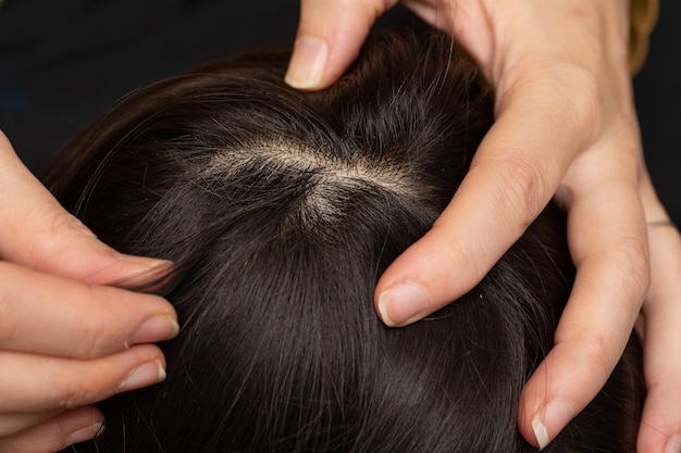 Cuero cabelludo de mujer con raíces de cabello