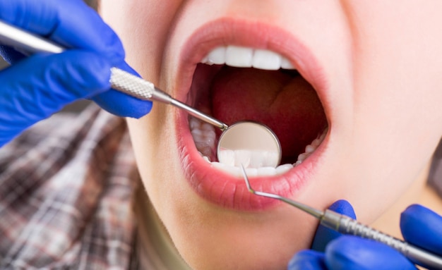 Cuidando los dientes. Mujer en el dentista. Cuidado dental, cuidado de los dientes.