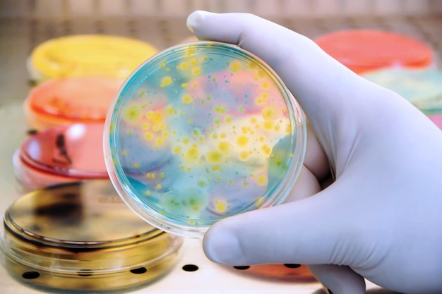 Cultura de colonias bacterianas en medios diferenciales y selectivos biotecnología salud