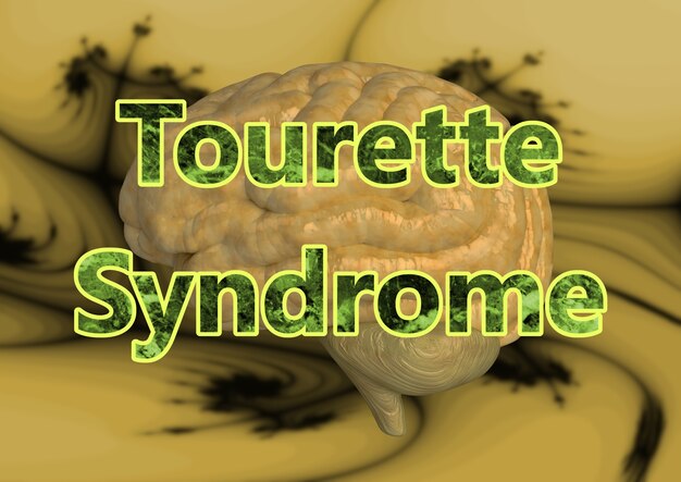 Das Lettering-Tourette-Syndrom ist eine neurologische Störung, die unkontrollierbare sich wiederholende Bewegungen oder unerwünschte Geräusche verursacht. 3D-Rendering