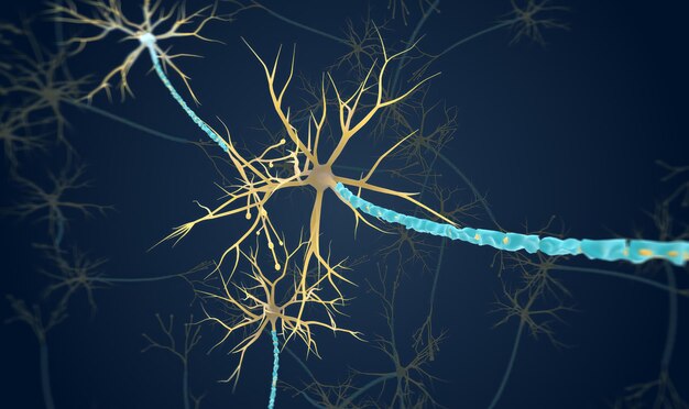 Foto das neuron mit degeneriertem myelin