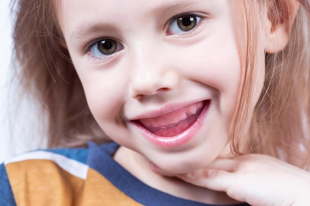 Das sechsjährige kaukasische Mädchen zeigt einen myofunktionellen Trainer in ihrem Mund