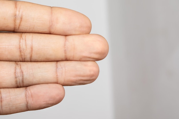 Dedos enrugados de uma mão masculina
