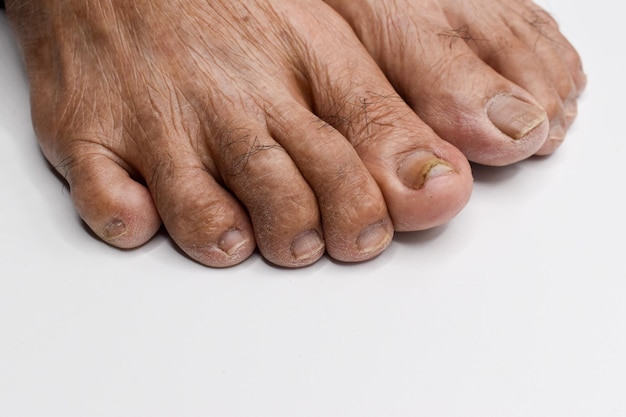 Dedos de los pies del anciano asiático Concepto de envejecimiento