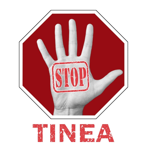 Foto deje de tiña ilustración conceptual. mano abierta con el texto stop tinea