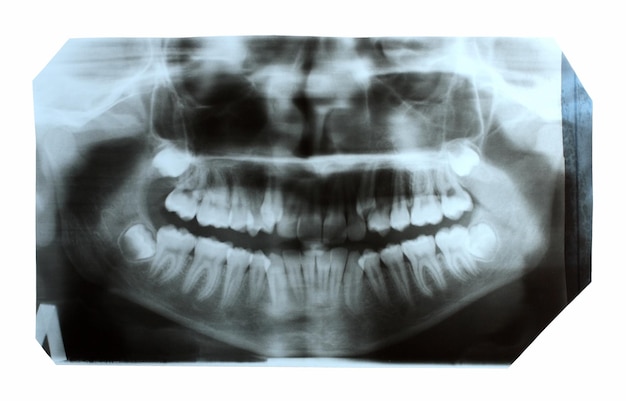 Dentales Röntgenbild des Kiefers