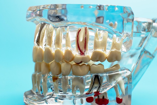 Foto dentalwerkzeug mit modell im zahnpflegekonzept