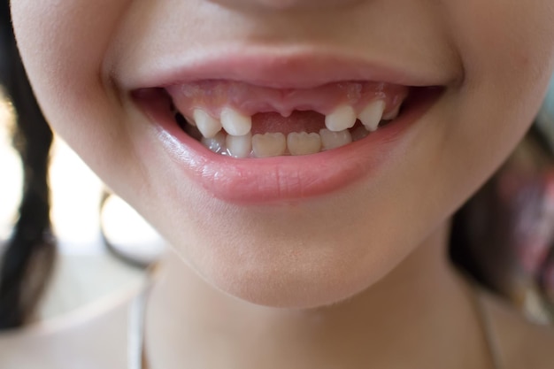 Dente de leite perdido de perto