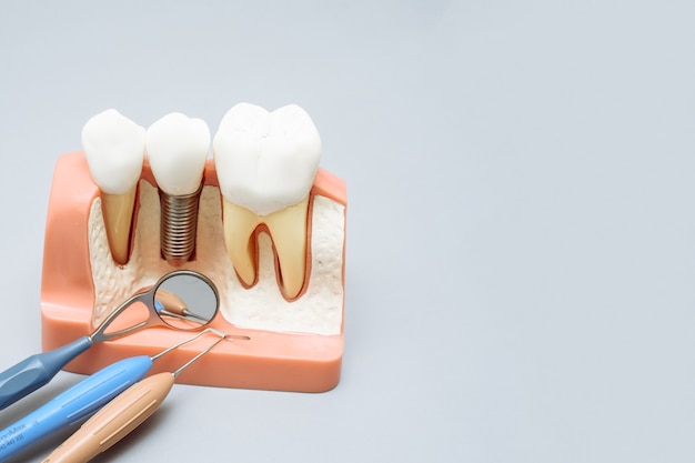 Dentes artificiais ao lado de ferramentas de dentista em um fundo cinza