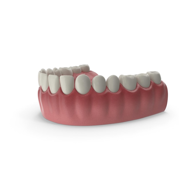 Foto dentes inferiores modelo médico com implante dentário mandíbula com posição anormal dos dentes ortodontia