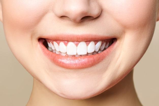 Dentes saudáveis perfeitos sorriem de uma jovem mulher