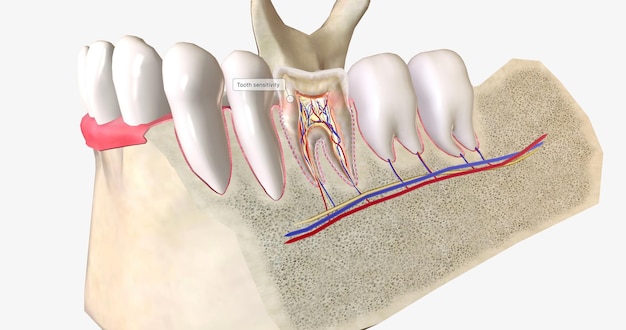 Foto dentes sensíveis é uma condição dental comum caracterizada por dor de dente aguda