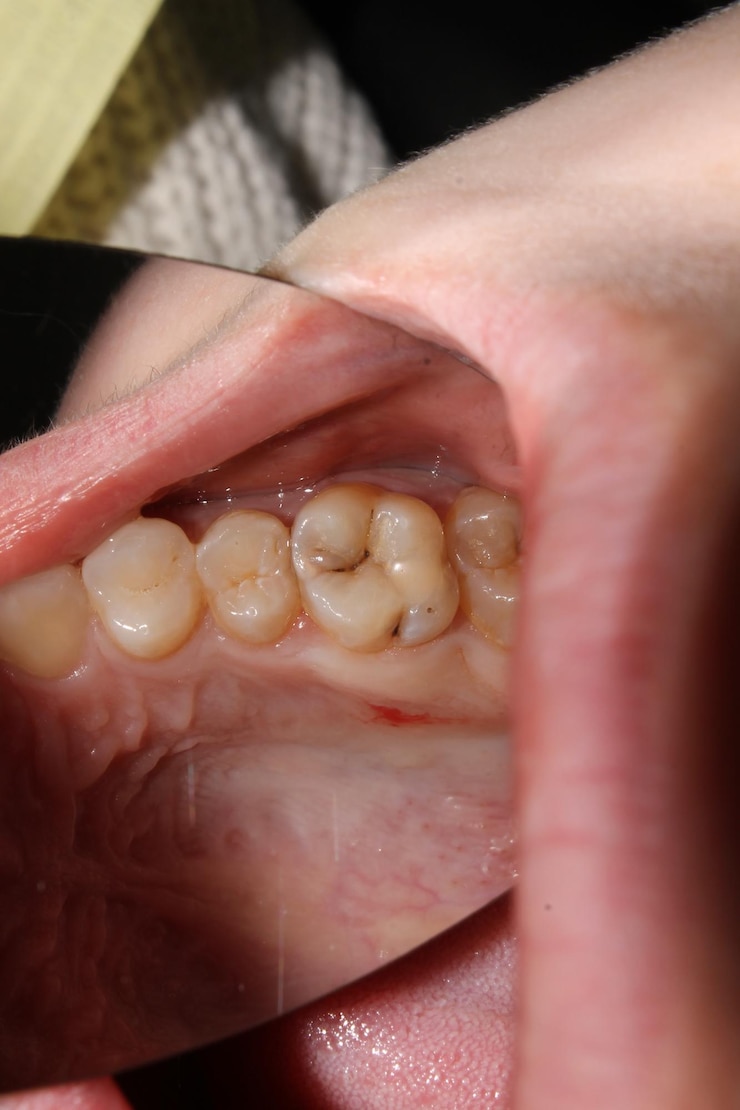 Foto dentes