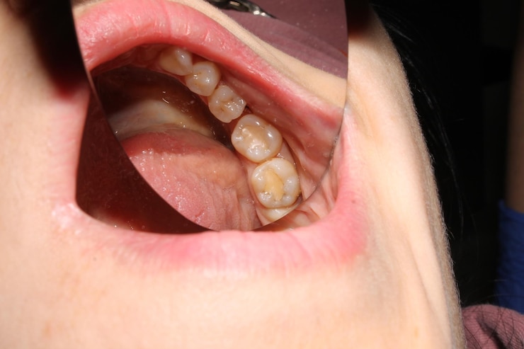 Foto dentes
