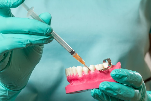 Dentista com layout da mandíbula humana e seringa