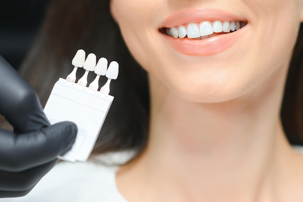 Dentista comprobando y seleccionando el color de los dientes de una mujer joven