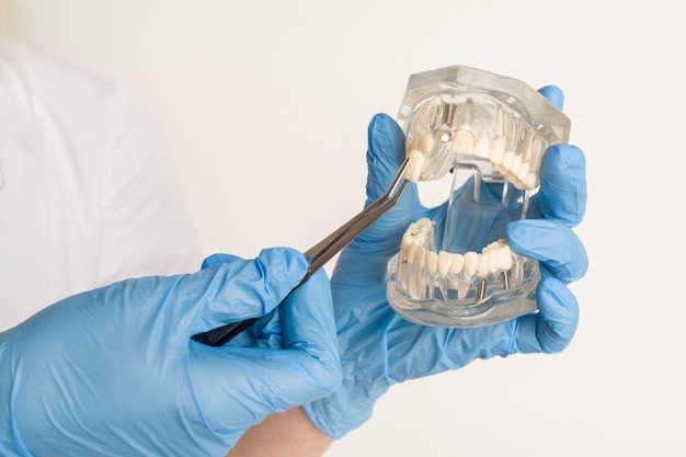 Dentista demonstra problemas com os dentes no exemplo do layout da mandíbula