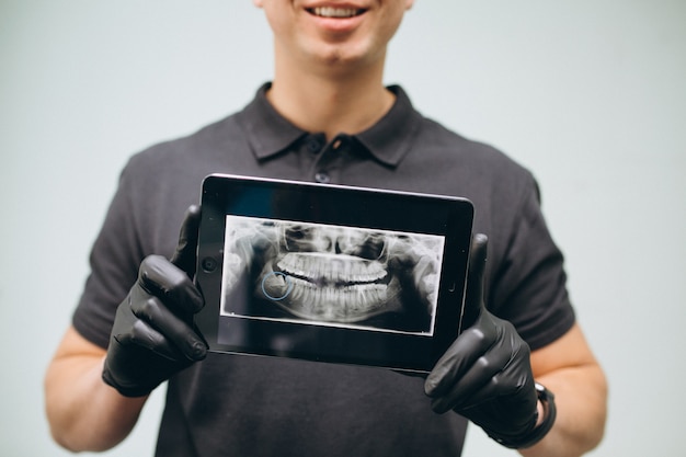 Dentista con dientes de rayos