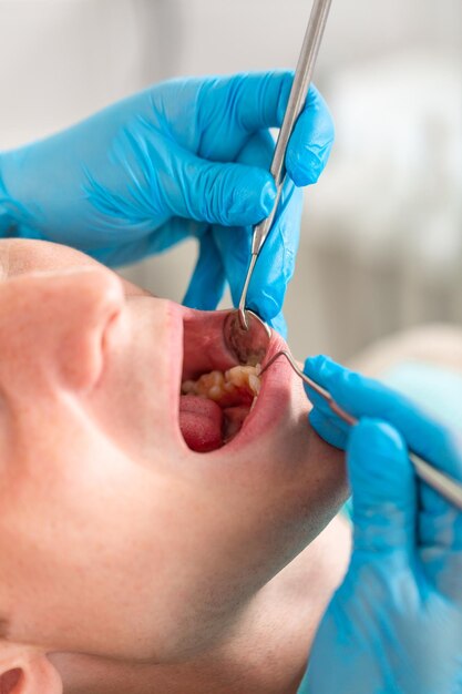 Foto una dentista examina la cavidad oral del paciente con una herramienta con un retrato de primer plano en espejo