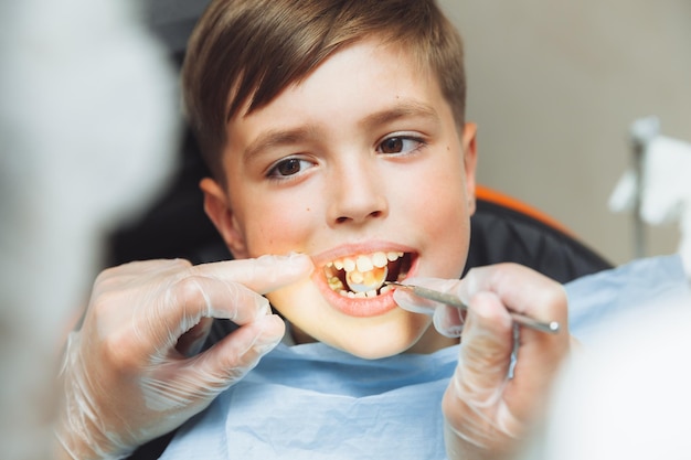 El dentista examina los dientes del niño en la clínica odontología pediátrica prevención y tratamiento de dientes