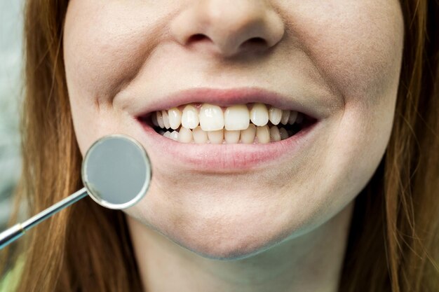 Dentista examinando los dientes de la niña en la clínica Problema dental Sonrisa saludable