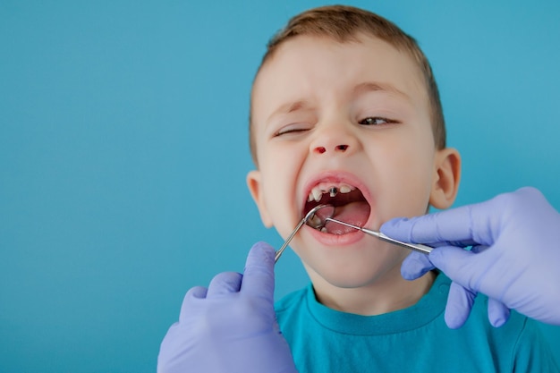 Dentista examinando os dentes do menino em fundo azul Um pequeno paciente na cadeira odontológica sorri Dantist trata os dentes vista de perto do dentista tratando os dentes do menino no consultório do dentista