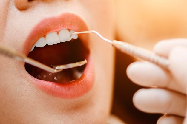 Dentista examinando pacientes de dentes na clínica para uma melhor saúde bucal e um sorriso brilhante.
