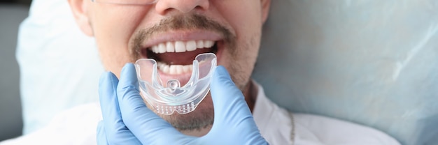 Dentista experimentando protetor bucal para paciente do sexo masculino