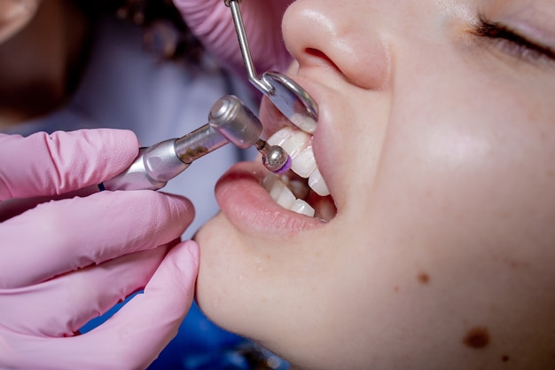 Dentista, fazendo dentes profissionais, limpeza de paciente jovem do sexo feminino no consultório odontológico. plano de close-up.