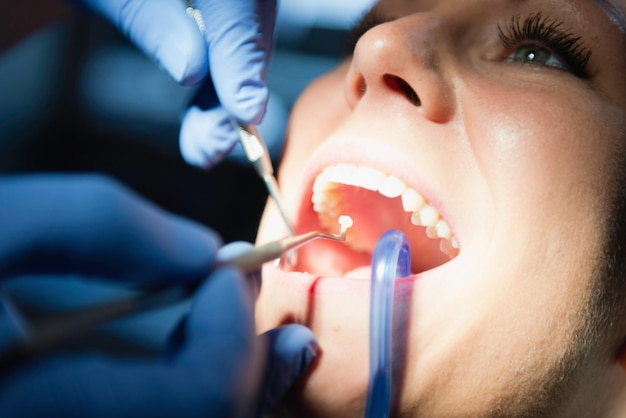 Dentista fazendo obturação dentária no consultório do dentista