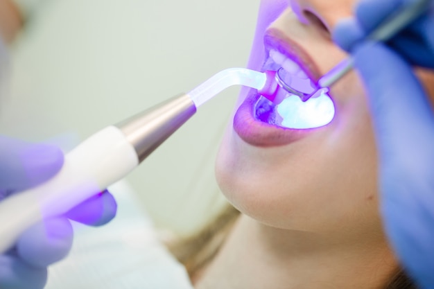 Foto dentista fazendo procedimento com luz uv de cura dental na clínica