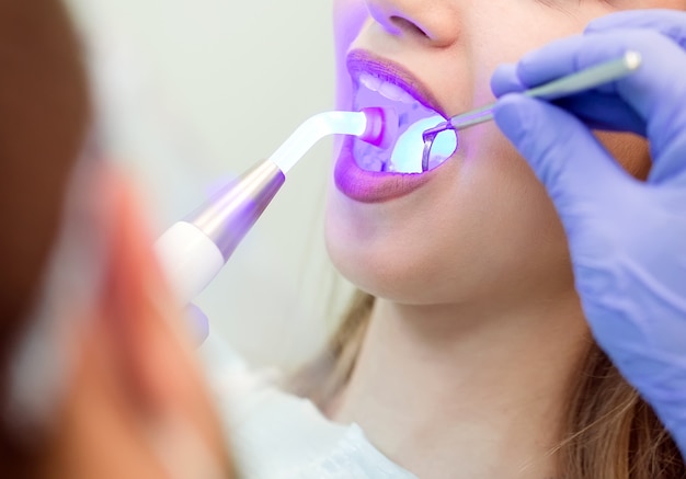 Dentista fazendo procedimento com luz UV de cura dental na clínica