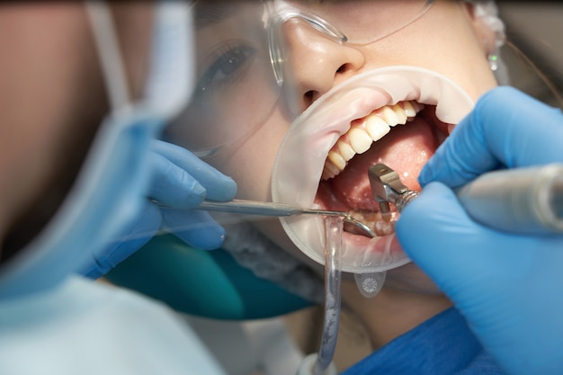 Dentista fazendo um tratamento odontológico em uma paciente do sexo feminino. Dentista examinando os dentes de um paciente em um consultório odontológico moderno