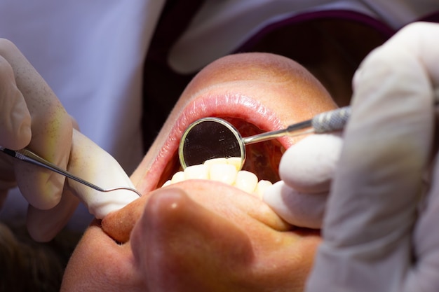 Dentista con guantes de látex con un pequeño espejo y un instrumento de ortodoncia que controla los dientes del paciente