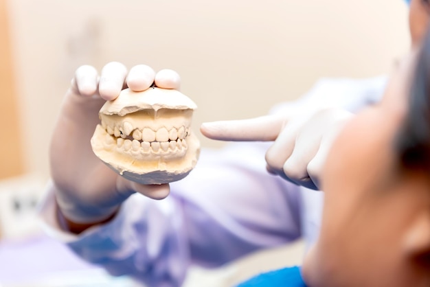 Foto dentista con implante dental dientes postizos. concepto de odontología y atención médica en la clínica dental.