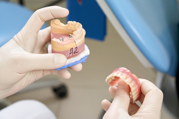 Dentista masculino mostrando a su paciente un implante dental en la clínica moderna