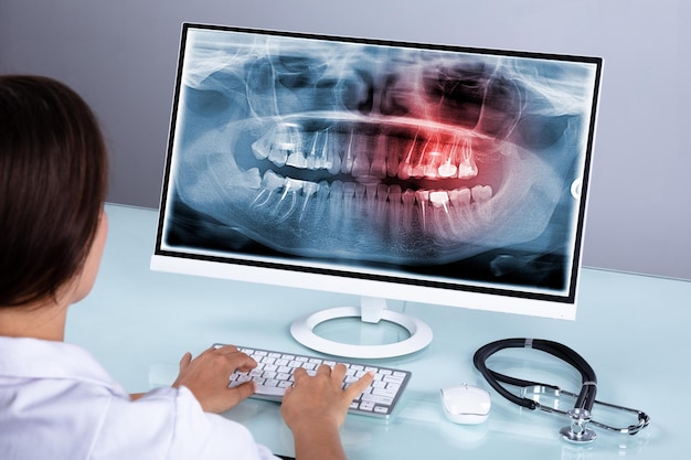 Dentista mirando la radiografía de los dientes en la computadora