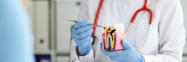 El dentista muestra en un modelo dental cómo la caries destruye el esmalte dental, la higiene diaria y el cuidado dental