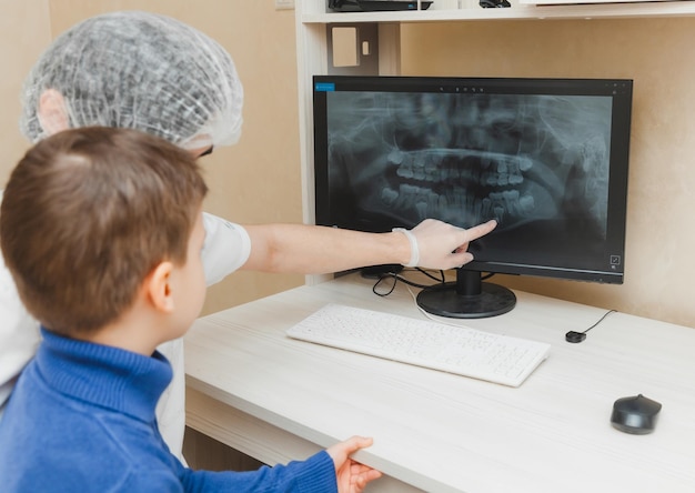 El dentista muestra la radiografía de los dientes en la computadora al niño paciente