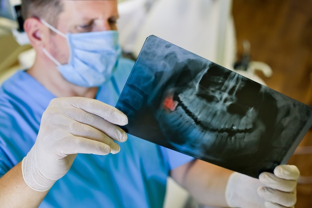 Dentista sosteniendo una foto una radiografía en sus manos