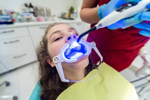 El dentista usa una lámpara ultravioleta mientras le coloca aparatos ortopédicos a la niña